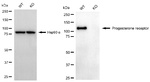 Progesterone Receptor Antibody in Western Blot (WB)