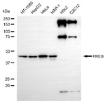 PREB Antibody in Western Blot (WB)