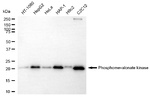 PMVK Monoclonal Antibody (25GB5200)