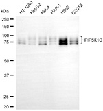 PIP5K1C Antibody in Western Blot (WB)