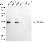 PIP4K2A Monoclonal Antibody (24GB13955)