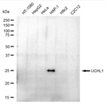 PGP9.5 Antibody in Western Blot (WB)