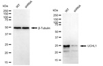 PGP9.5 Antibody in Western Blot (WB)