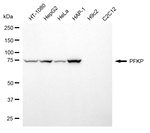 PFKP Antibody in Western Blot (WB)
