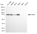 PFKP Antibody in Western Blot (WB)