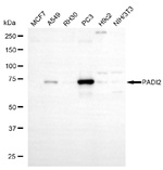 PADI2 Monoclonal Antibody (25GB6005)