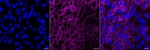 PACSIN3 Monoclonal Antibody (25GB500)