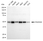 PACSIN3 Antibody in Western Blot (WB)