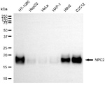 NPC2 Antibody in Western Blot (WB)