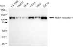 NOTCH1 Recombinant Rabbit Monoclonal Antibody (25GB425)
