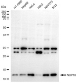 NOLA3 Antibody in Western Blot (WB)