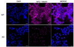 NF2 Antibody in Immunocytochemistry (ICC/IF)