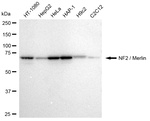 NF2 Antibody in Western Blot (WB)