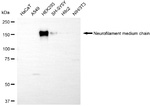 NF-M Antibody in Western Blot (WB)