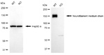 NF-M Antibody in Western Blot (WB)