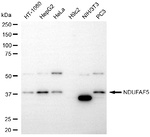 NDUFAF5 Antibody in Western Blot (WB)
