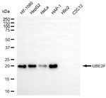 NCE2 Antibody in Western Blot (WB)