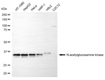 NAGK Antibody in Western Blot (WB)