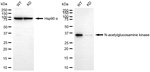 NAGK Antibody in Western Blot (WB)