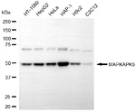 MAPKAPK5 Monoclonal Antibody (25GB5805)