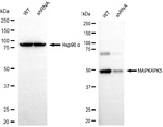 MAPKAPK5 Antibody in Western Blot (WB)