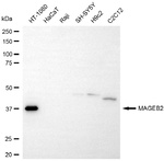 MAGEB2 Antibody in Western Blot (WB)