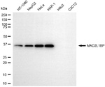 MAD2L1BP Monoclonal Antibody (25GB5820)