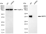 M6PR Antibody in Western Blot (WB)
