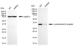 LTBR Antibody in Western Blot (WB)