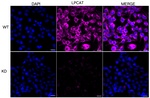 LPCAT1 Antibody in Immunocytochemistry (ICC/IF)