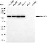 LPCAT1 Antibody in Western Blot (WB)