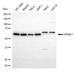 KPNA1 Monoclonal Antibody (25GB700)