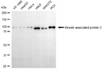 KAP3 Recombinant Rabbit Monoclonal Antibody (25GB3160)