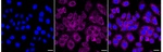 IGF2BP3 Recombinant Rabbit Monoclonal Antibody (23GB6345)