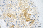 IGF2BP2 Recombinant Rabbit Monoclonal Antibody (25GB6765)
