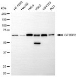 IGF2BP2 Antibody in Western Blot (WB)
