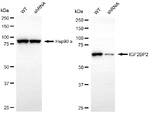 IGF2BP2 Antibody in Western Blot (WB)