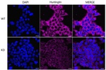Huntingtin Antibody in Immunocytochemistry (ICC/IF)