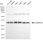 HNRNPA0 Antibody in Western Blot (WB)