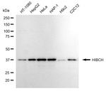 HIBCH Antibody in Western Blot (WB)