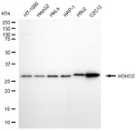 HDHD2 Antibody in Western Blot (WB)