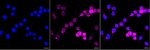 HDAC8 Antibody in Immunocytochemistry (ICC/IF)