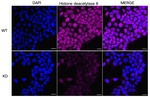 HDAC8 Antibody in Immunocytochemistry (ICC/IF)