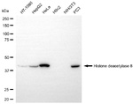 HDAC8 Antibody in Western Blot (WB)