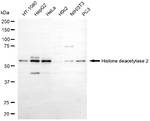 HDAC2 Monoclonal Antibody (25GB475)