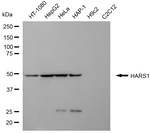HARS Antibody in Western Blot (WB)