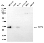 GSTT2 Monoclonal Antibody (24GB13940)
