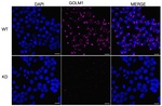 GOLPH2 Antibody in Immunocytochemistry (ICC/IF)