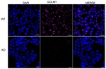 GOLPH2 Antibody in Immunocytochemistry (ICC/IF)