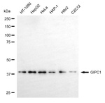 GIPC1 Monoclonal Antibody (24GB6650)